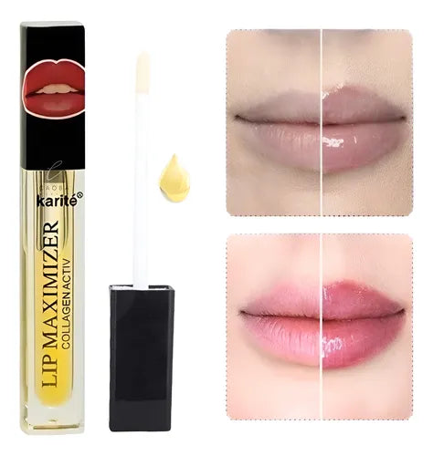 Voluminizador de Labios